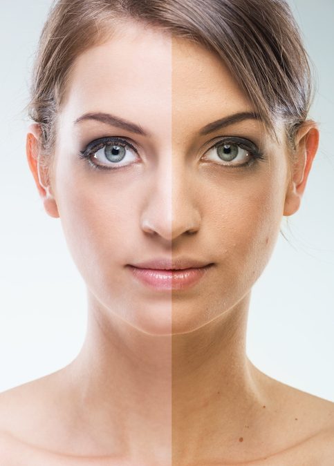 Millennials aren’t shy about plastic surgery on Instagram